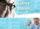 Thumbnail 51 Tips for Dealing with Kidney Stones