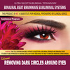 Thumbnail Removing Dark Circles Around Eyes Thumbnail Removing Dark Circles Around Eyes