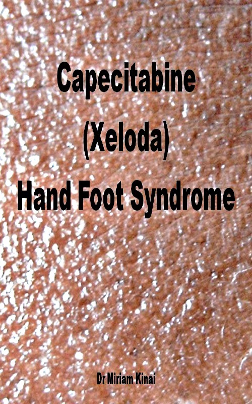 Capecitabine (Xeloda) Hand Foot Syndrome Tradebit