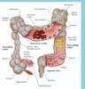Thumbnail 25 Fresh Article PLR about Colon Cleanse for Disember 2011
